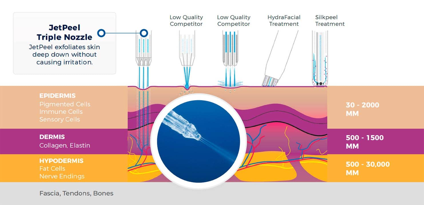 Jetpeel diagram photo