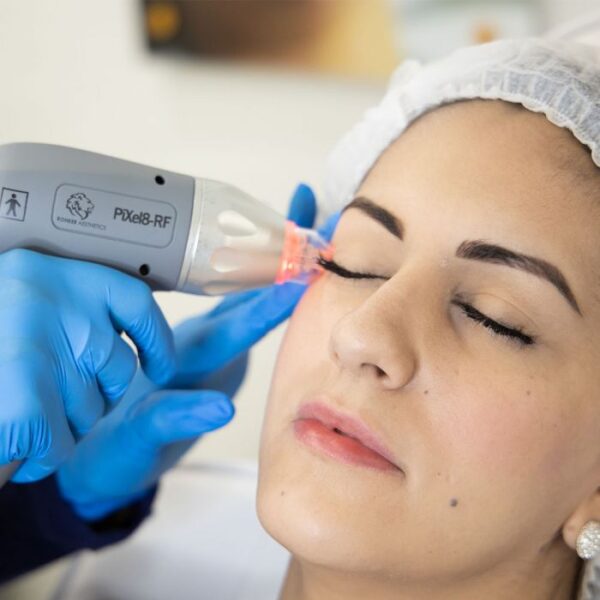PiXel8-RF MICRONEEDLING MACHINE - Image 2